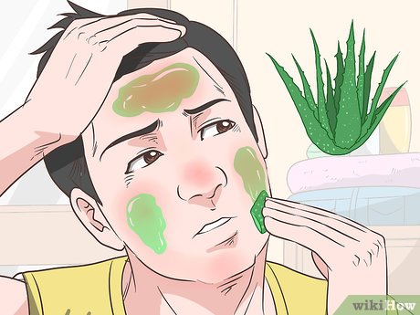 Benefits of Aloe Vera